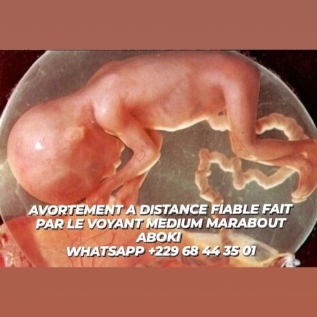 avortement-a-distance-serieux-big-0
